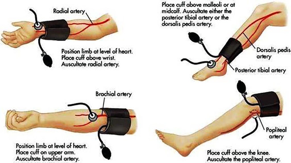 3-pressure-points-that-ll-instantly-lower-your-blood-pressure